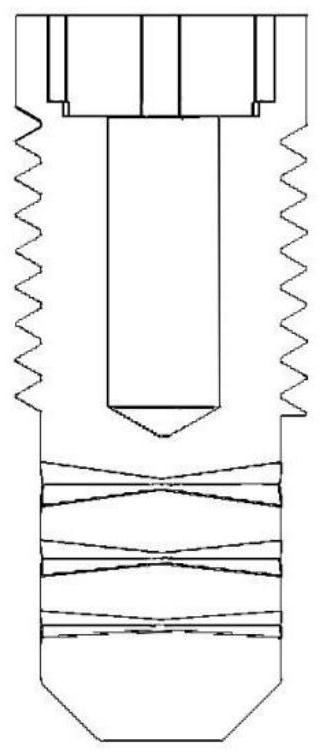 Multi-segment through-hole porous dental implant