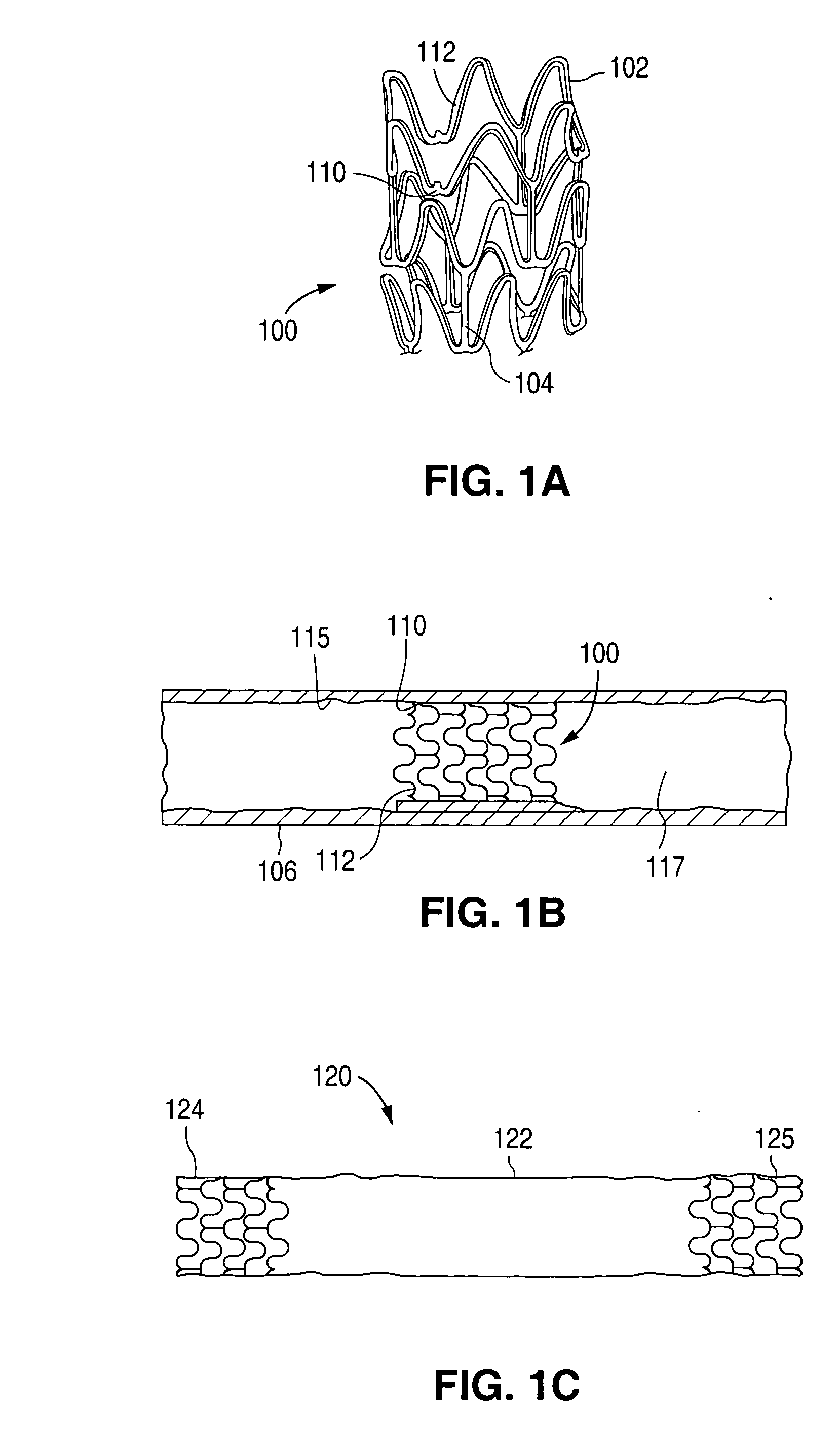 Surface features of an implantable medical device