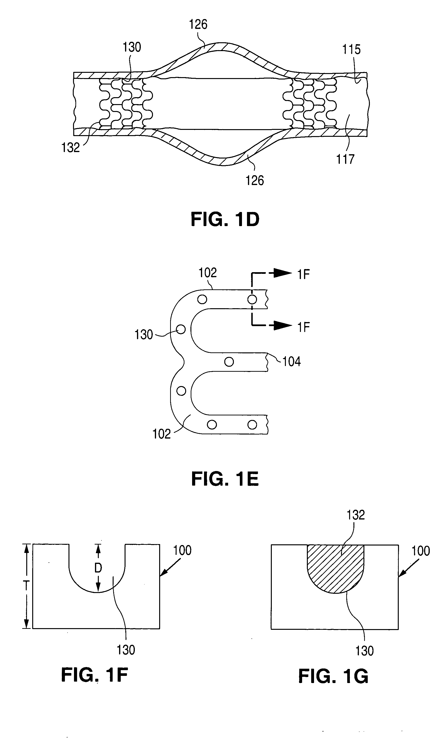 Surface features of an implantable medical device