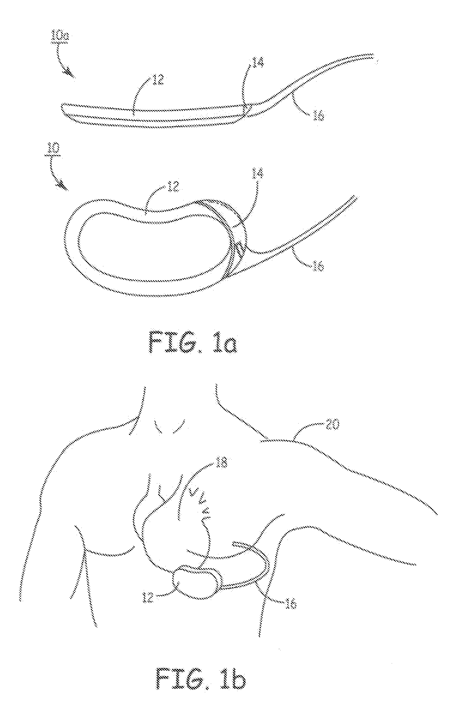 Methods and Apparatus for Selectively Shunting Energy in an Implantable Extra-Cardiac Defibrillation Device