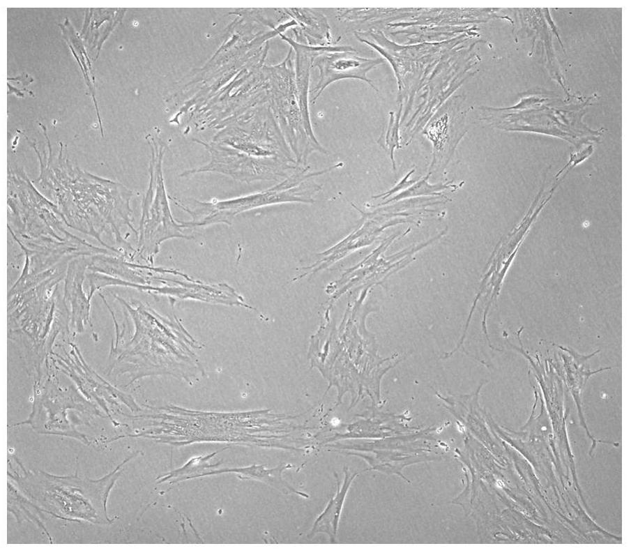 A human placental site trophoblastic tumor cell line