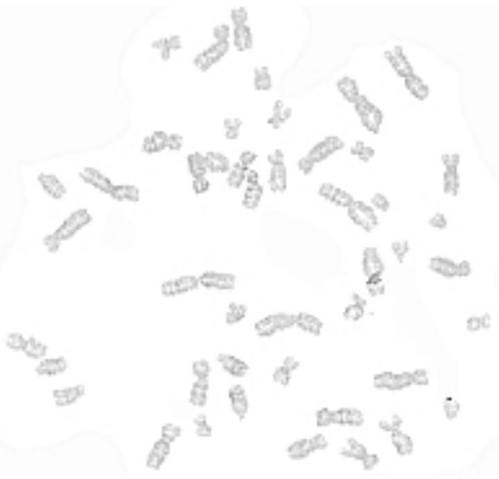 A human placental site trophoblastic tumor cell line