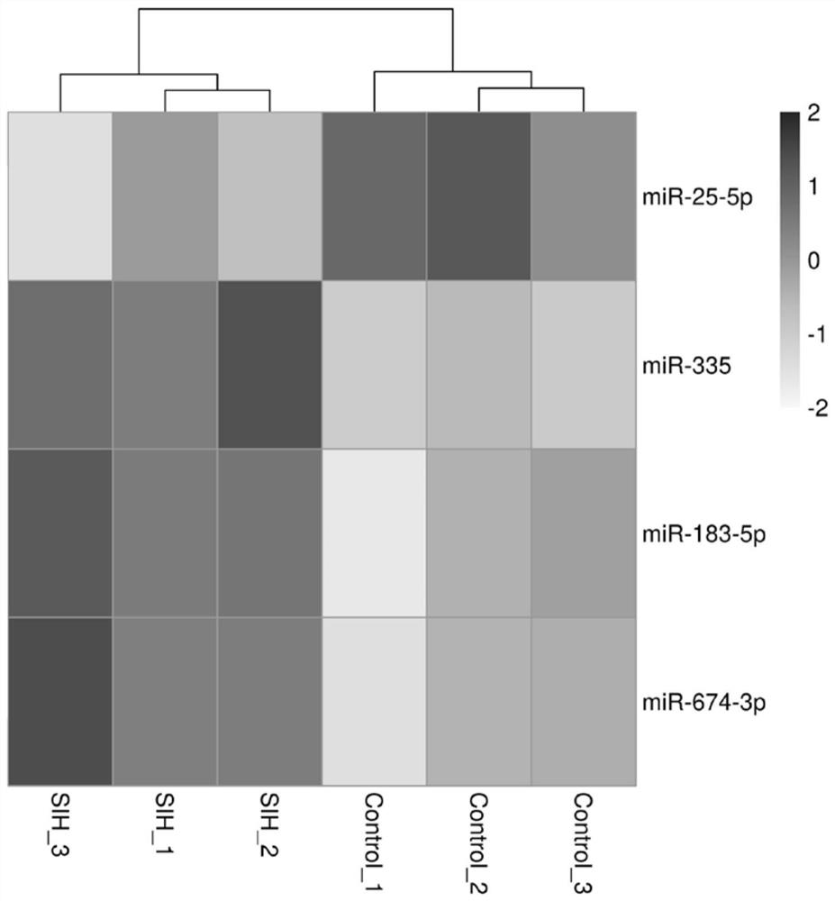 Application of miR-674-3p in preparation of drugs for preventing or treating stress hypertension