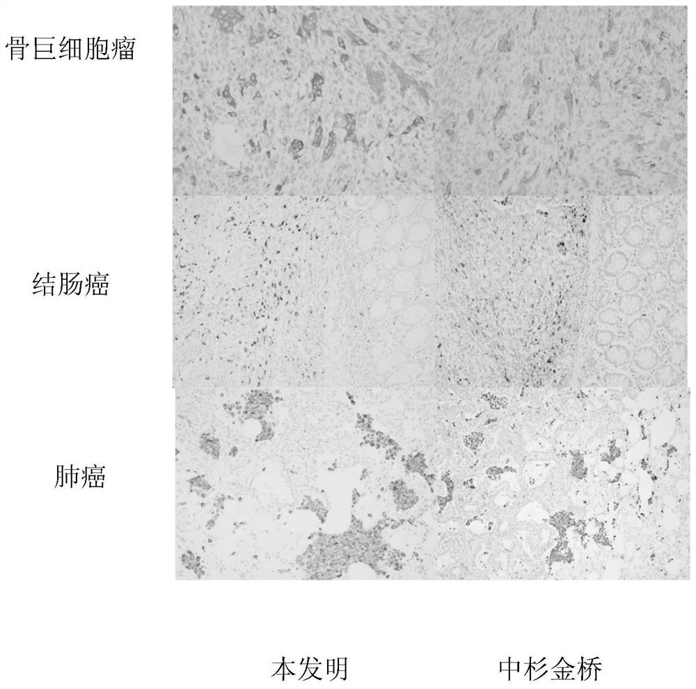 Hybridoma cell line, cd68 monoclonal antibody, preparation method and application