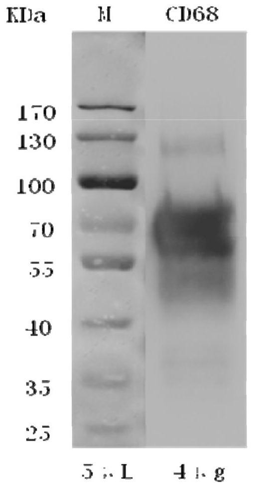 Hybridoma cell line, cd68 monoclonal antibody, preparation method and application