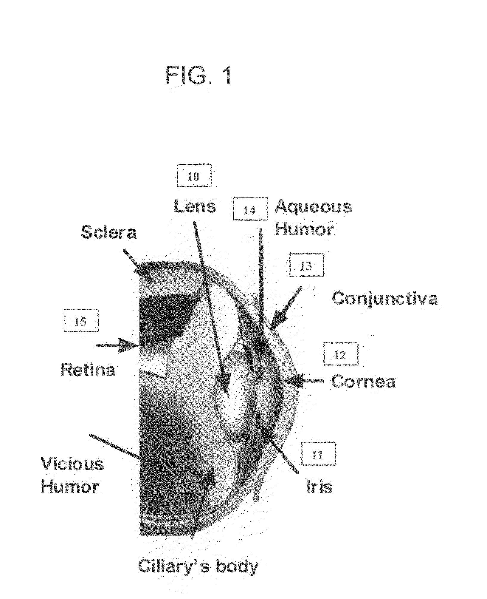 Method and apparatus for early diagnosis of Alzheimer's using non-invasive eye tomography by Teraherts