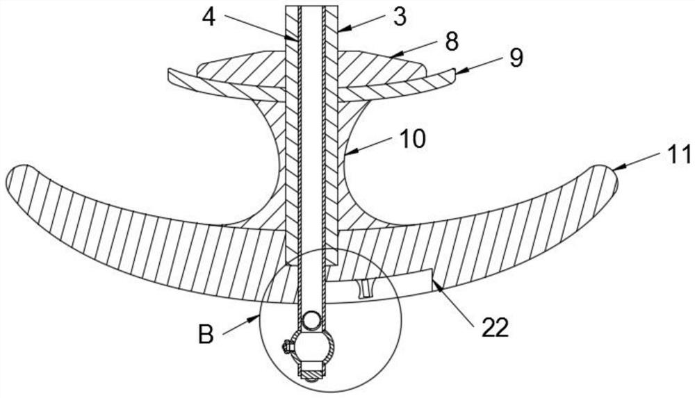 Progressive autologous anal dilatation device