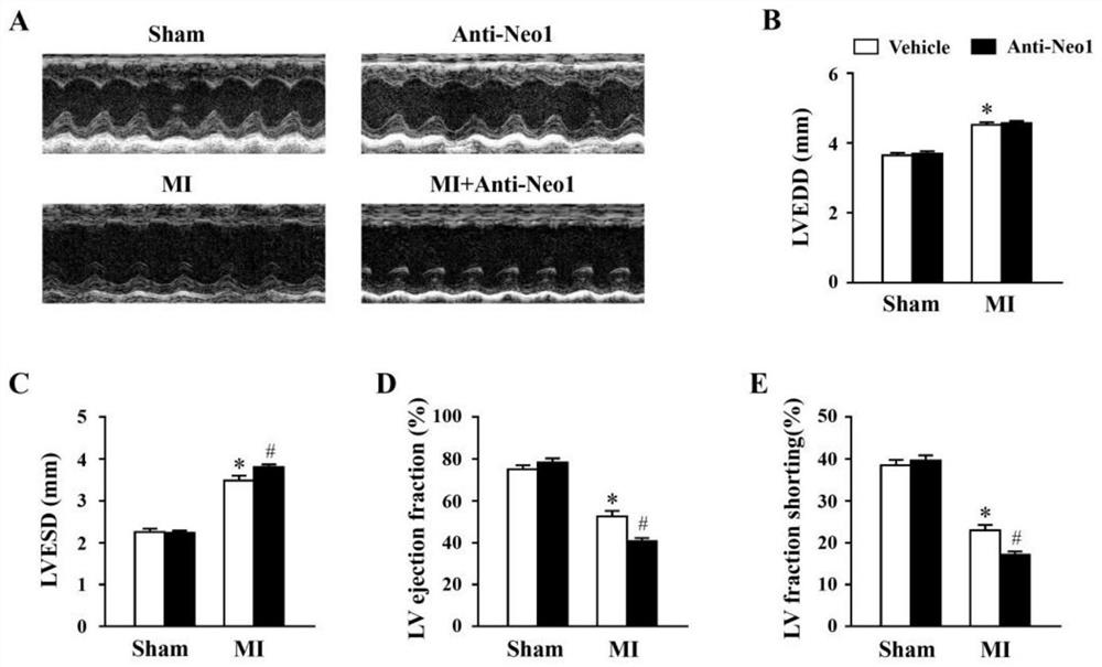 Application of Neogenin to preparation of medicine for preventing, relieving and/or treating myocardial infarction and related diseases thereof