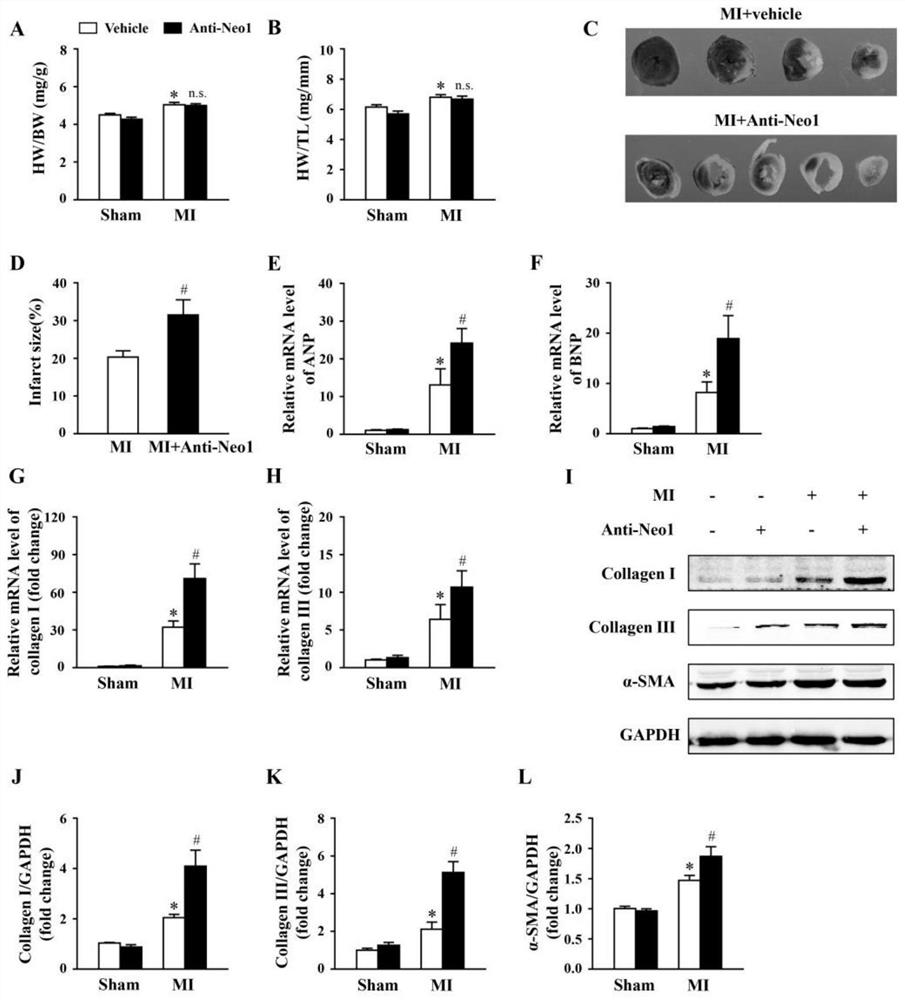 Application of Neogenin to preparation of medicine for preventing, relieving and/or treating myocardial infarction and related diseases thereof