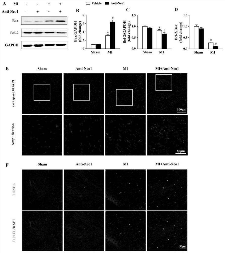 Application of Neogenin to preparation of medicine for preventing, relieving and/or treating myocardial infarction and related diseases thereof