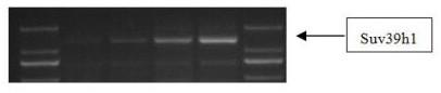 Mouse model for resisting to MLL leukemia by changing epigenetic modification level as well as establishing method and application of mouse model