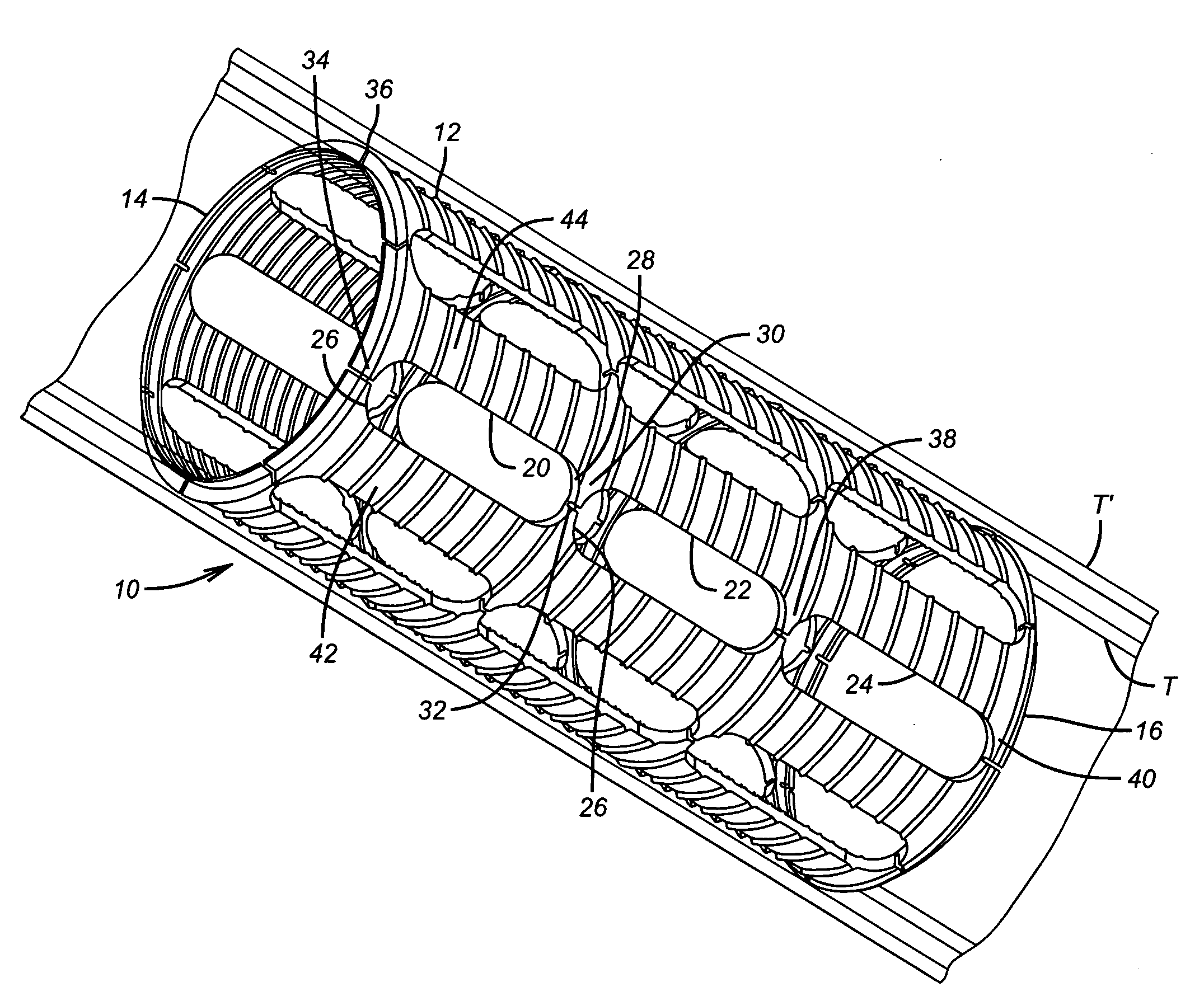 Expandable slip ring