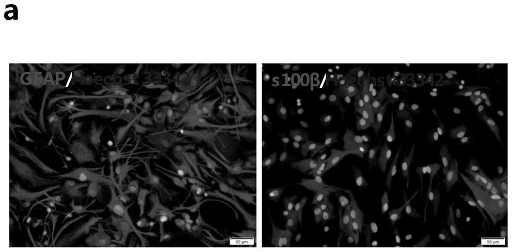 The application of mir containing the specific seed base sequence at the 5' end, the improved Schwann cell and its application