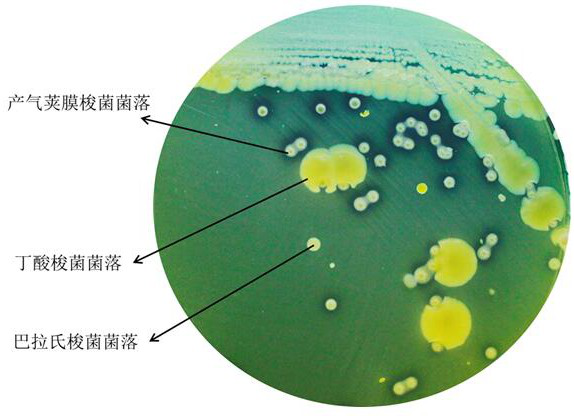 Culture medium for separating and counting clostridium butyricum