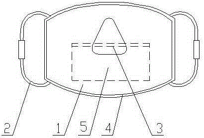 High-fitting-degree three-dimensional filtering mouth mask