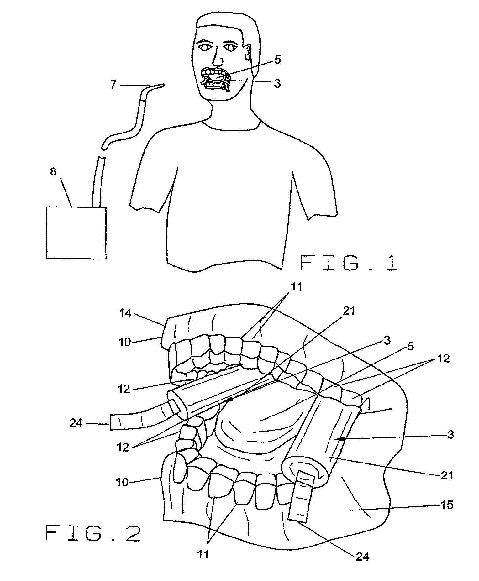 Intra-oral cavity surgical device