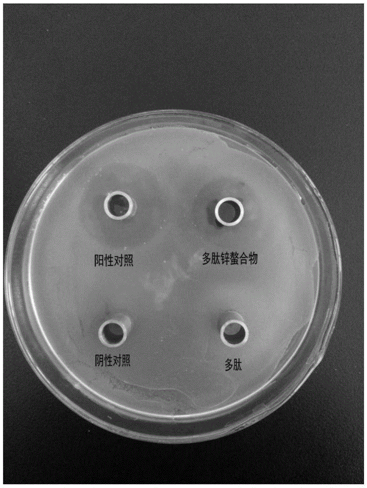 Preparation method for whitmania pigra Whitman polypeptide zinc chelate possessing antibacterial activity