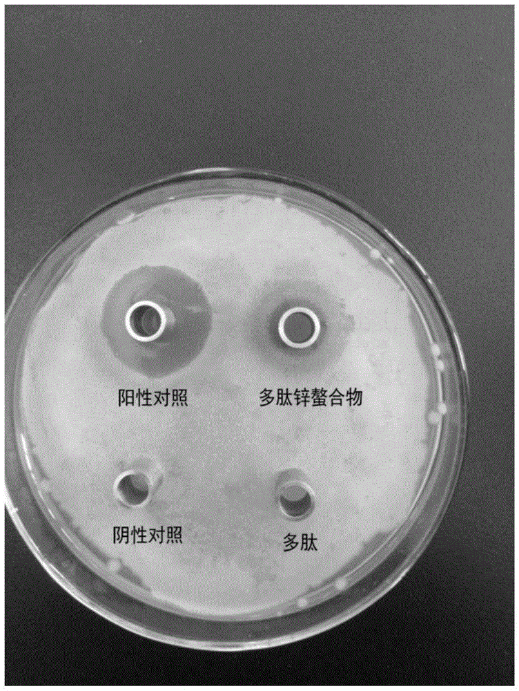 Preparation method for whitmania pigra Whitman polypeptide zinc chelate possessing antibacterial activity