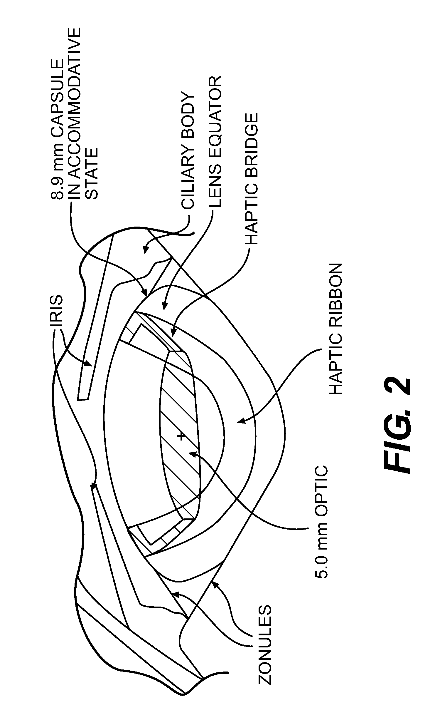 Pseudophakic Accommodating Intraocular Lens