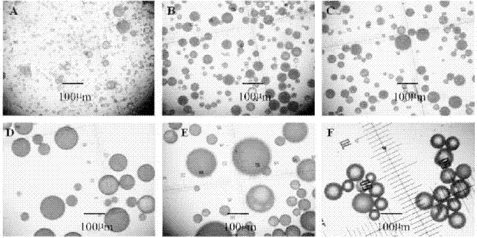 Method for preparing granulocyte-macrophage colony stimulating factor microsphere