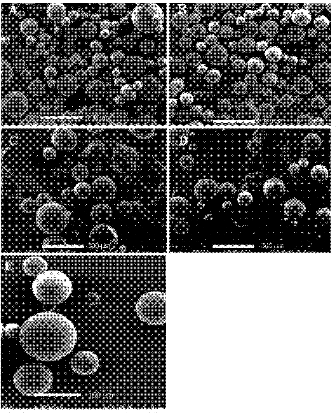 Method for preparing granulocyte-macrophage colony stimulating factor microsphere