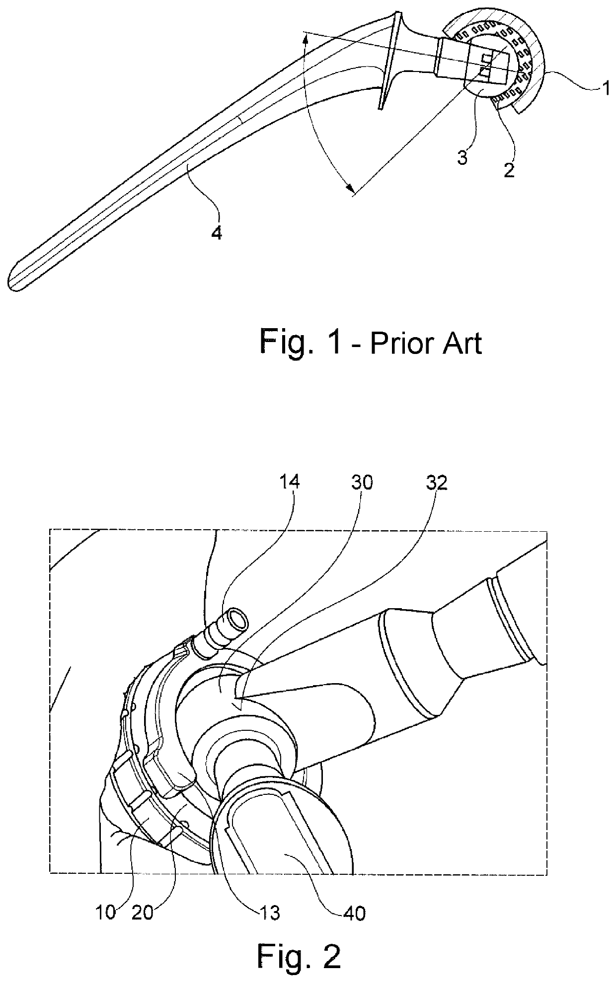 Double mobility prosthesis