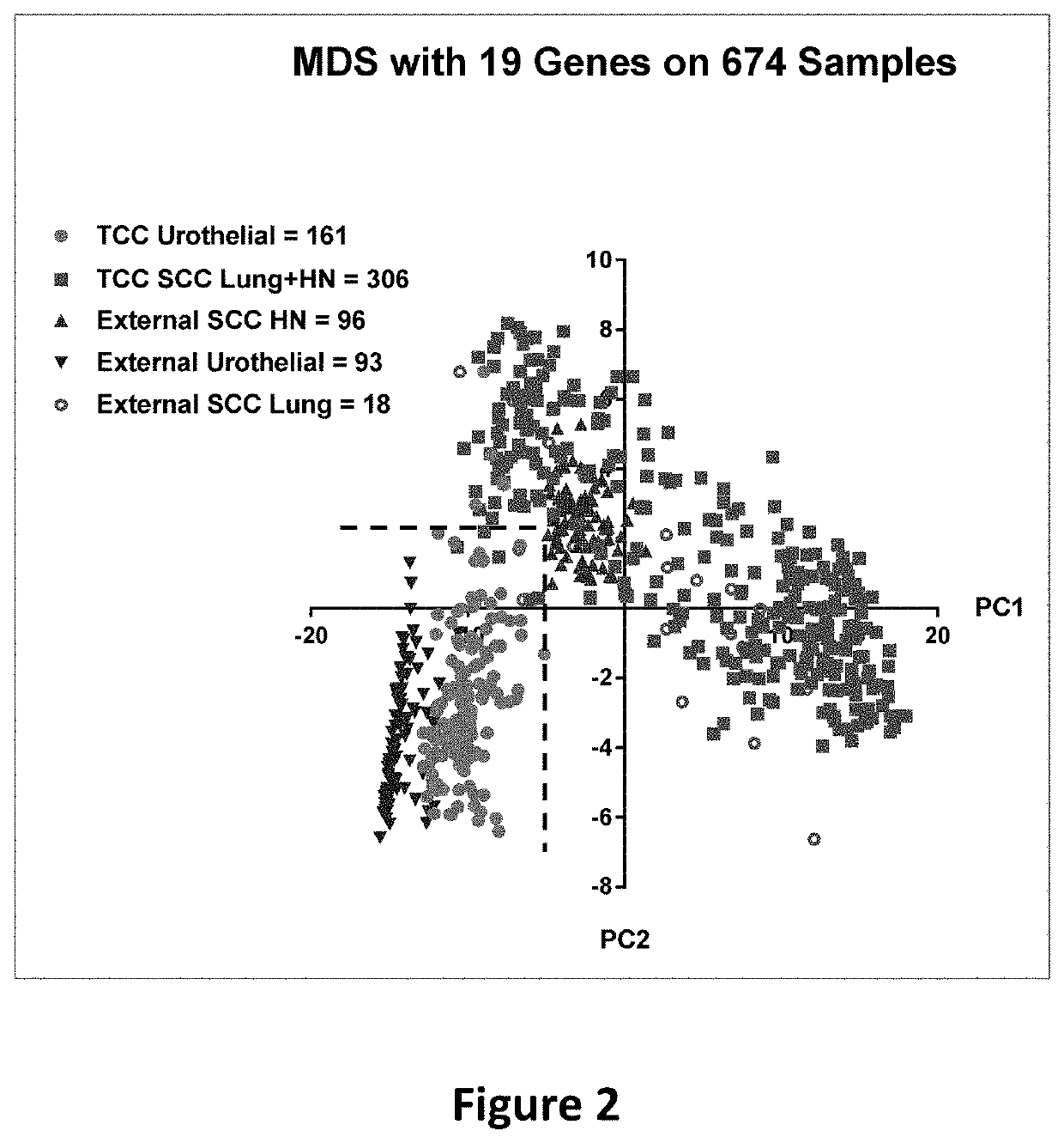 Method of distinguishing urothelial carcinoma from lung and head and neck squamous cell carcinoma