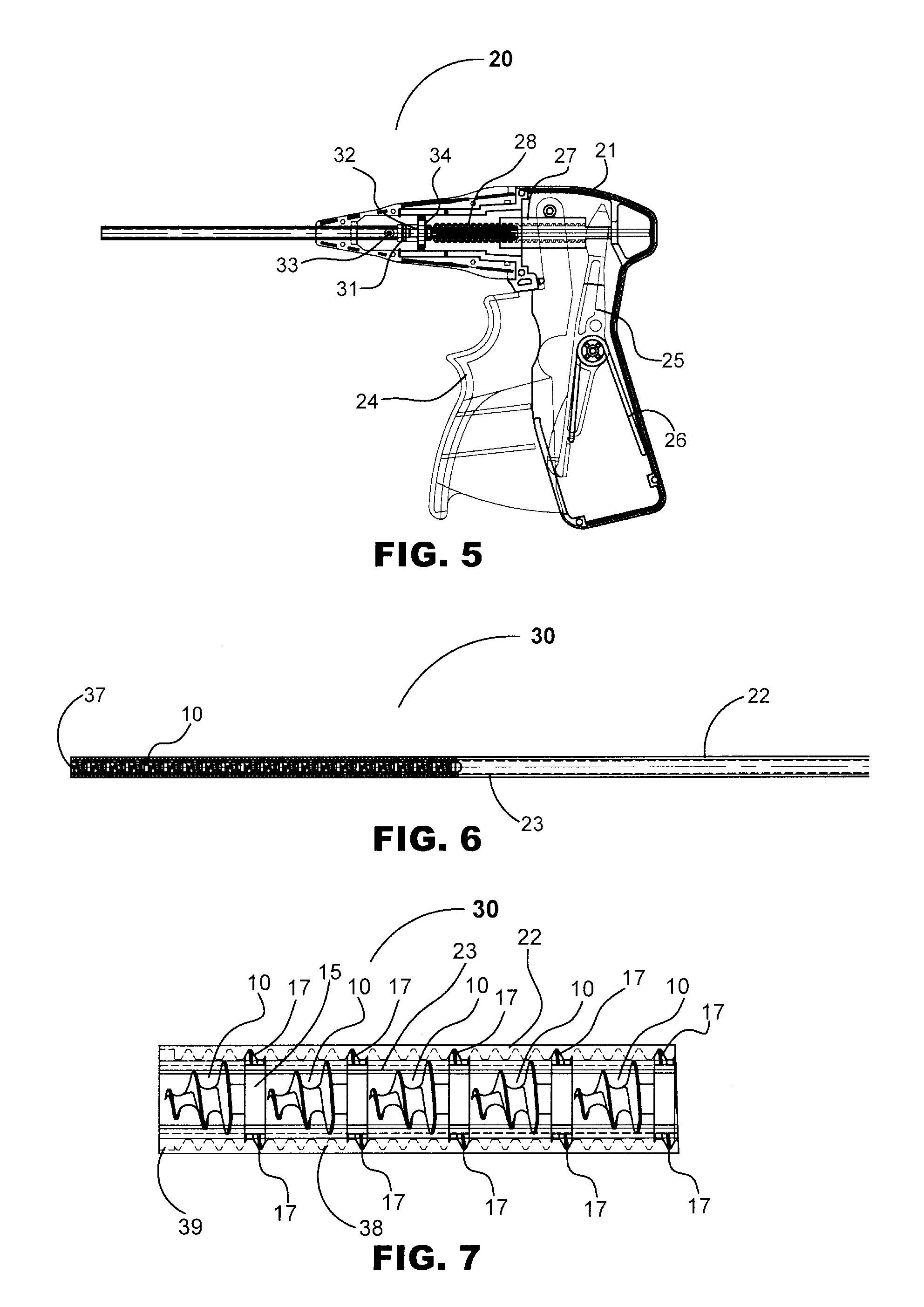 Absorbable Anchor for Hernia Mesh Fixation