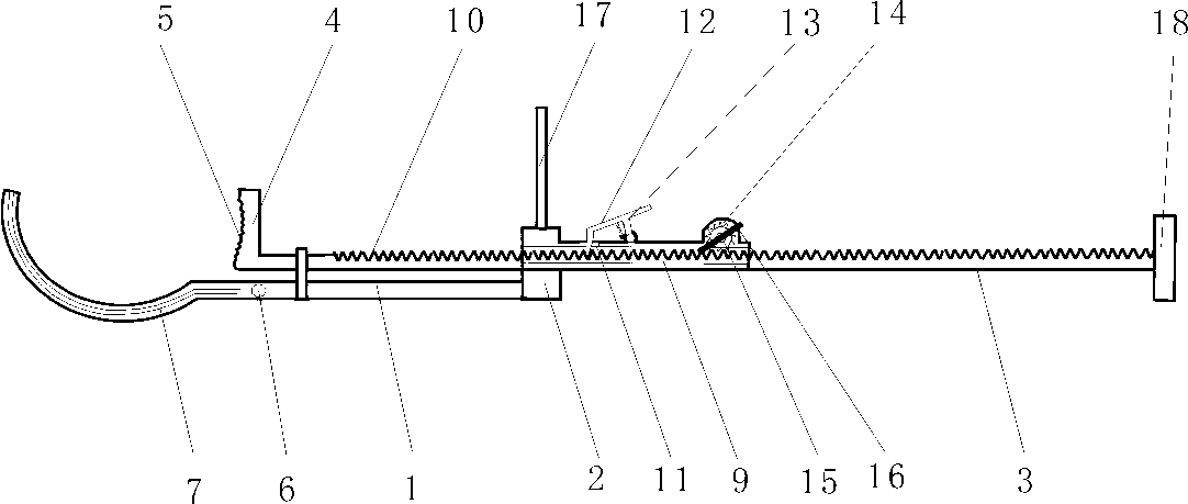 Machine for fixing and repositioning fractured femur lesser trochanter