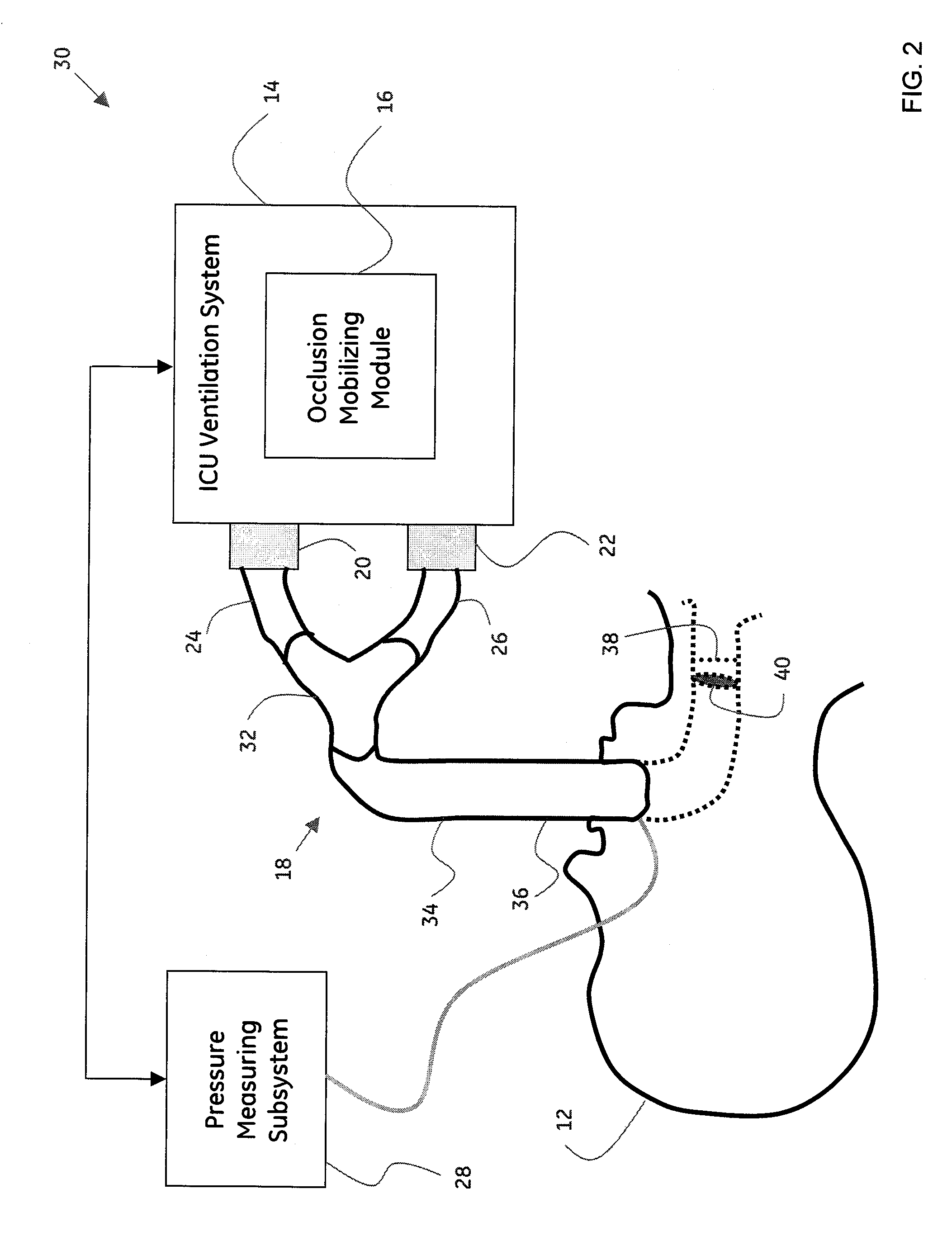 System and method for mobilizing occlusions from a breathing tube