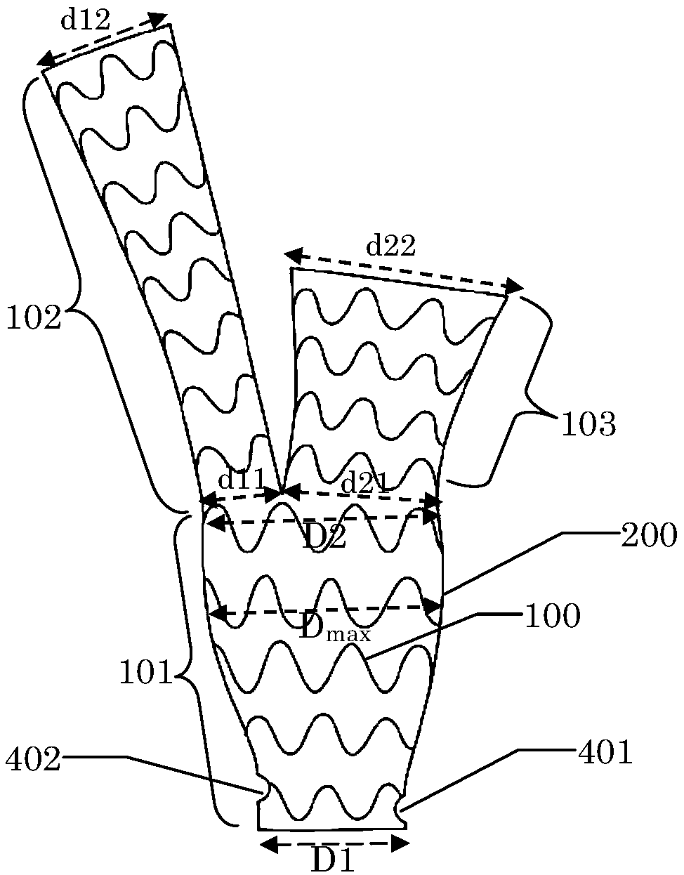 Ascending aortic stent graft