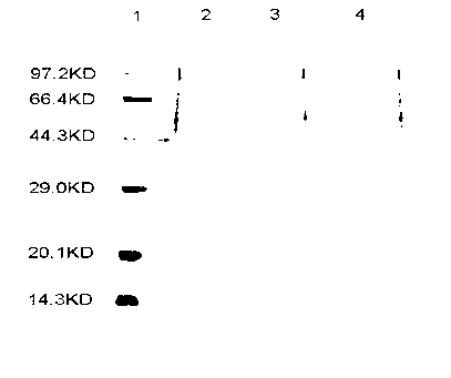 Space-induced efficient bifidobacterium bifidum and application thereof as well as preparation method of capsule preparation of space-induced efficient bifidobacterium bifidum