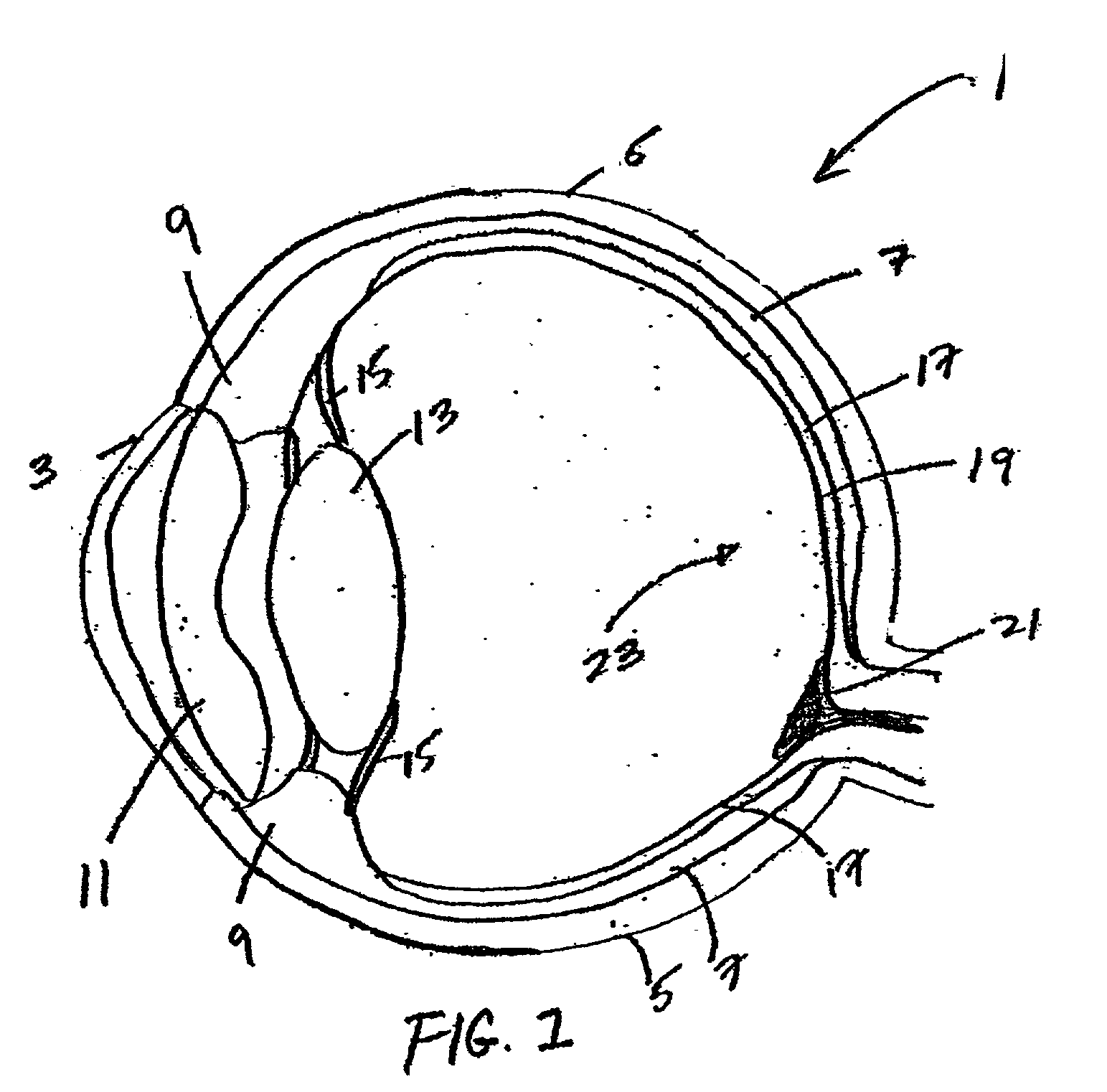 Ophthalmic instrument having hartmann wavefront sensor with extended source