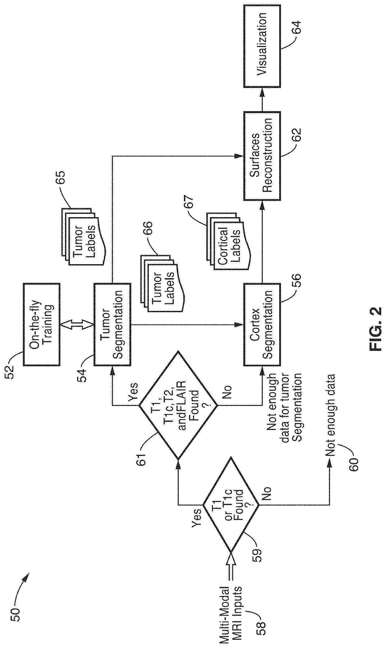 System of joint brain tumor and cortex reconstruction