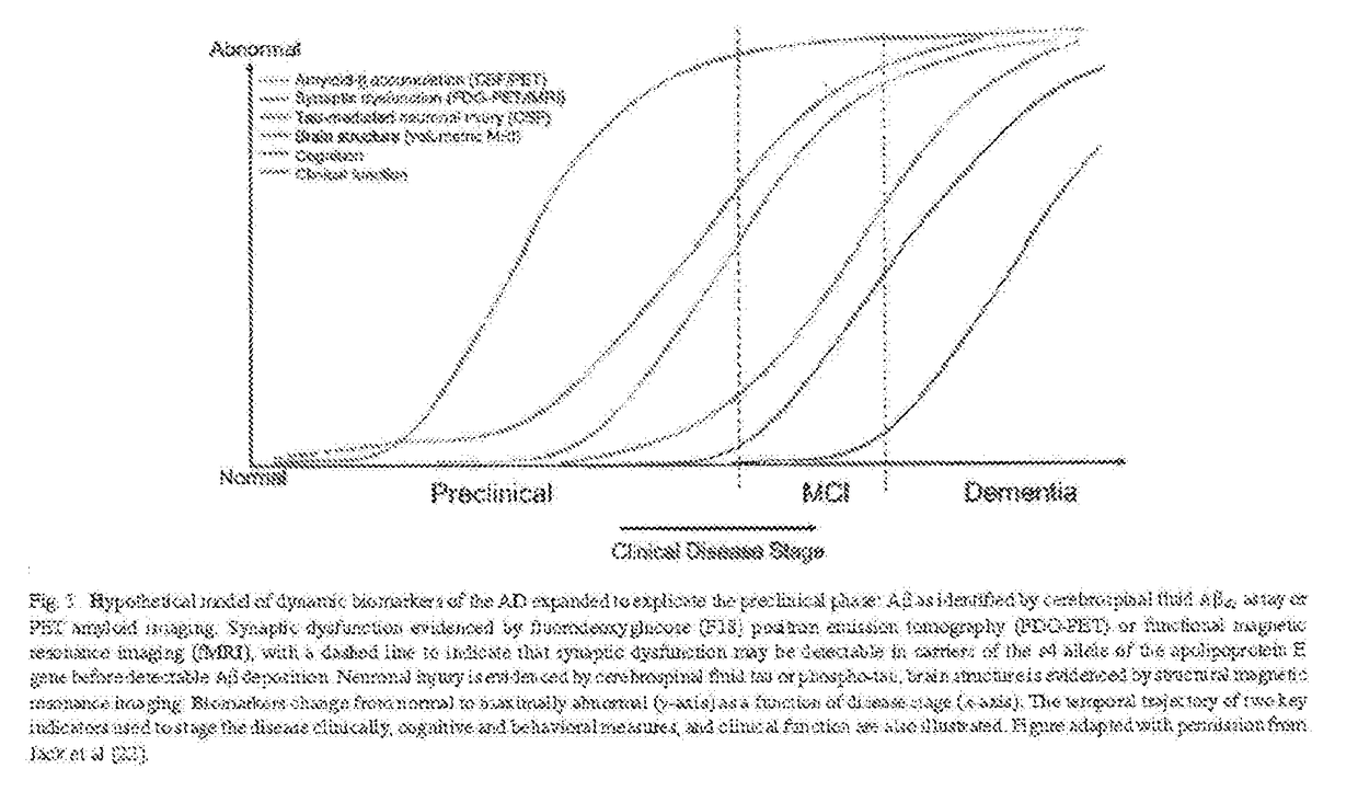 Galantamine clearance of amyloid ß