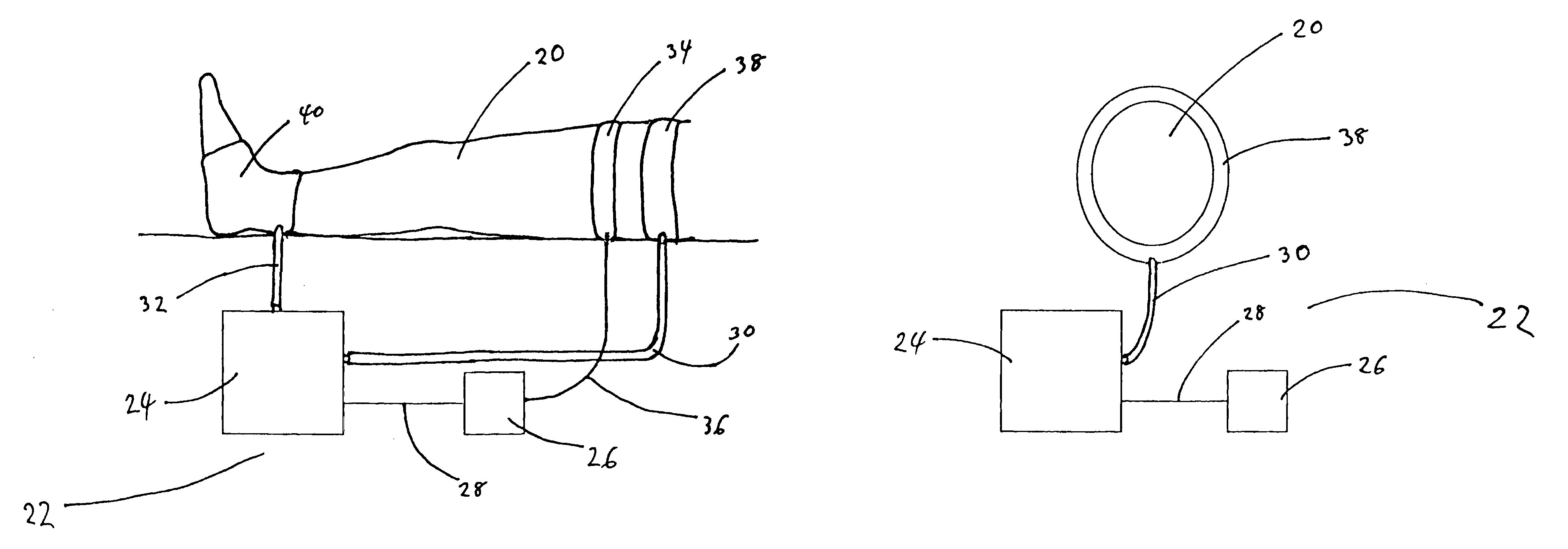 Thrombus prevention apparatus and methods