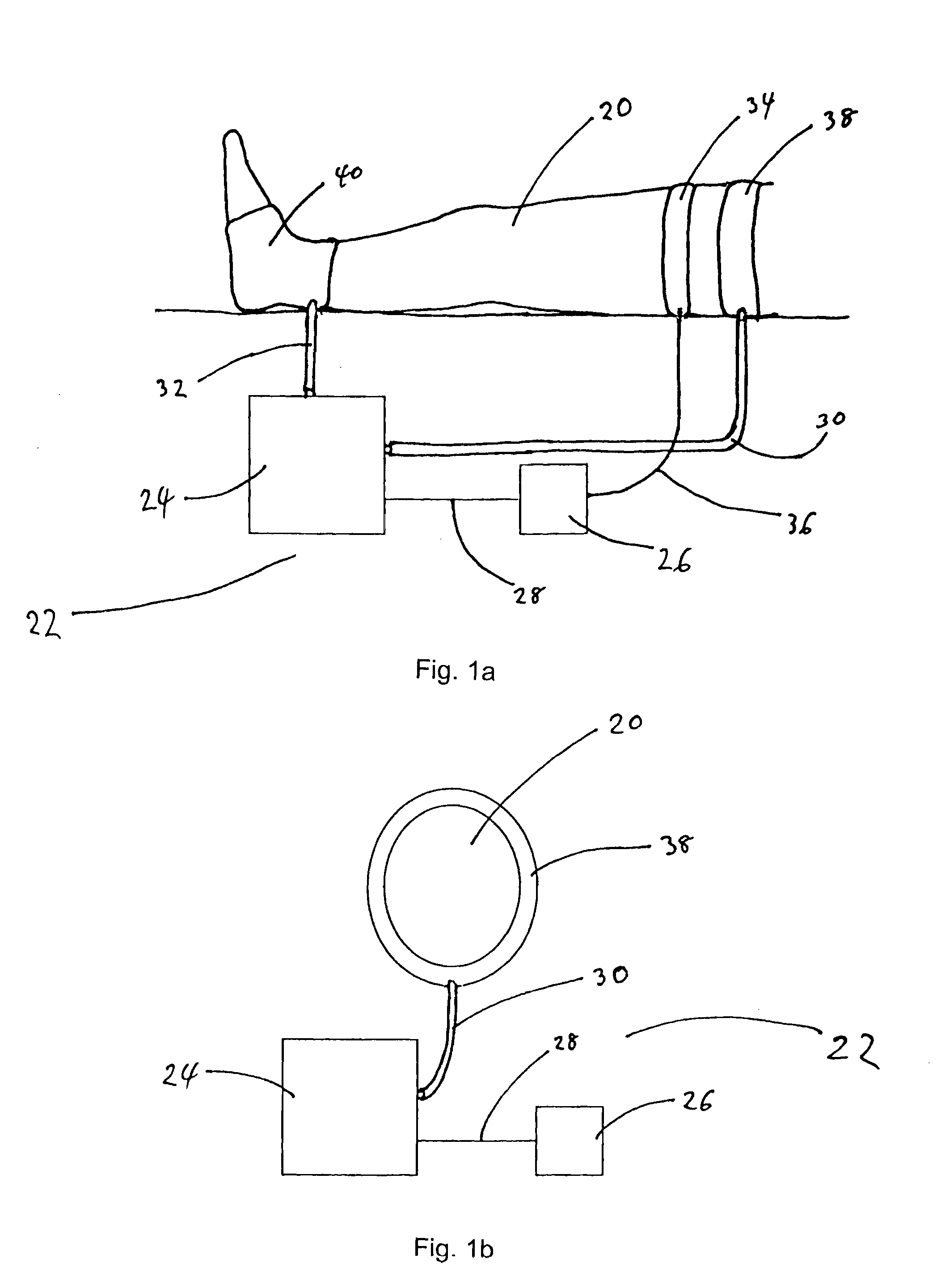 Thrombus prevention apparatus and methods