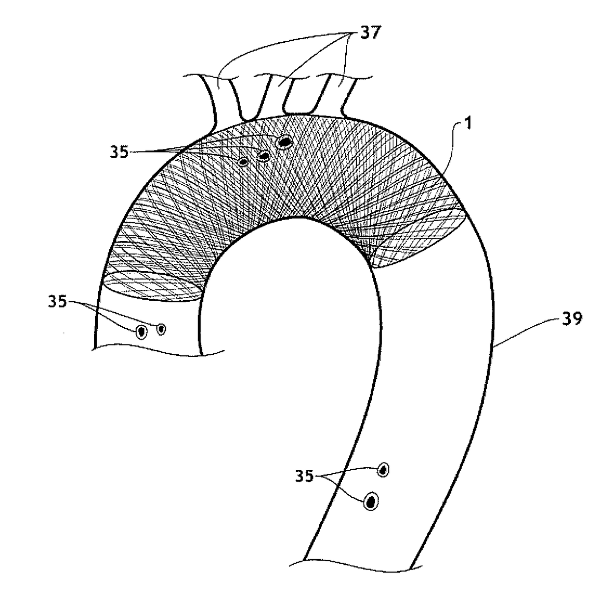 3D filter for prevention of stroke