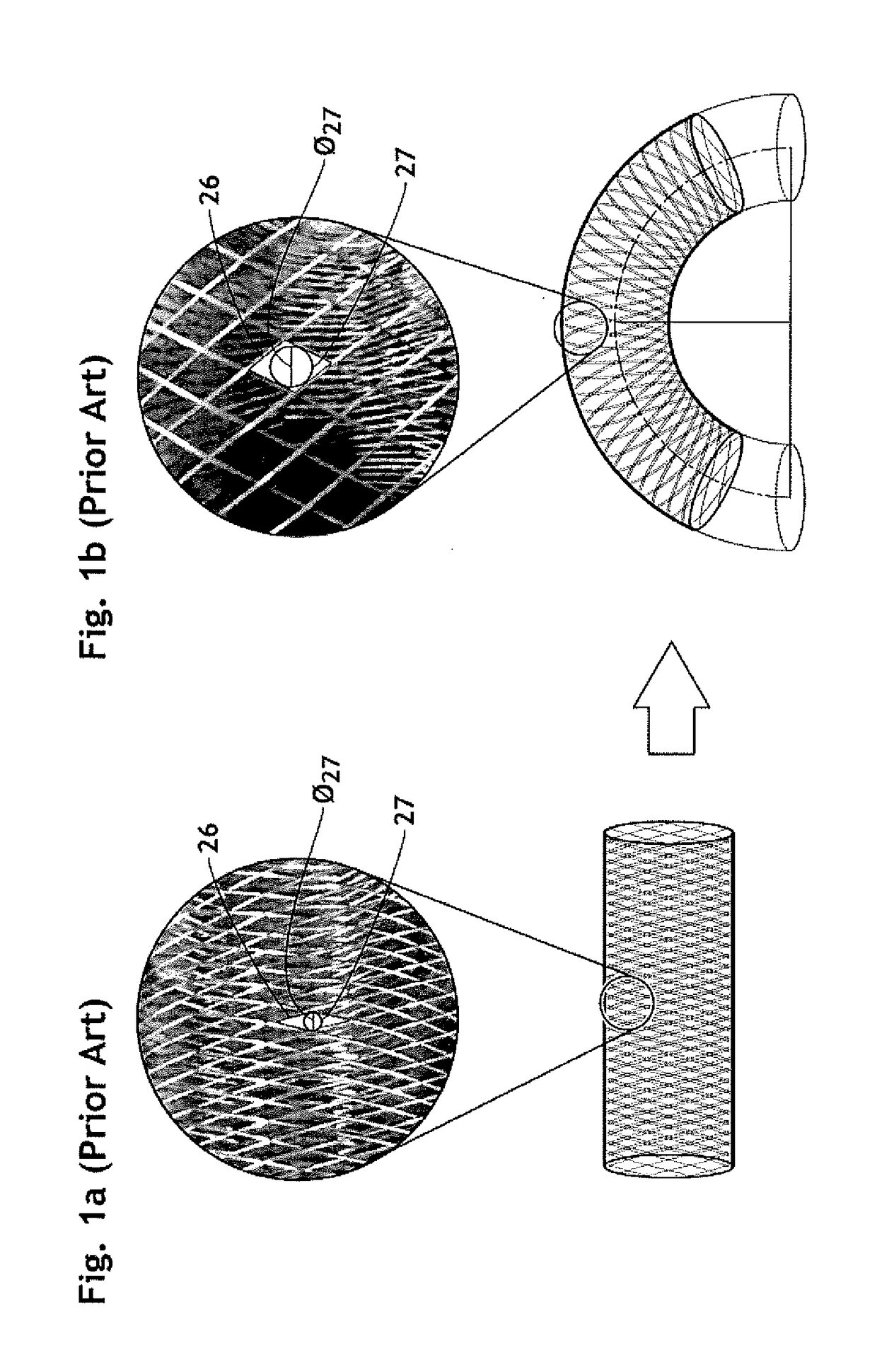 3D filter for prevention of stroke