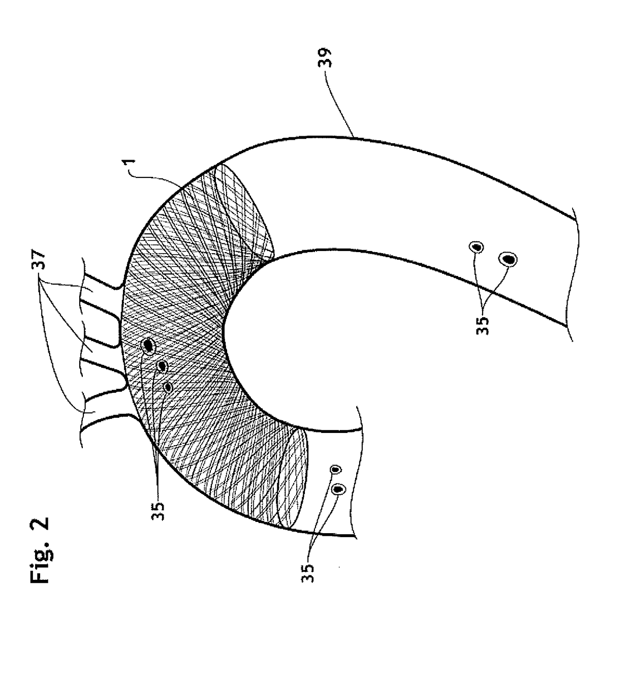 3D filter for prevention of stroke