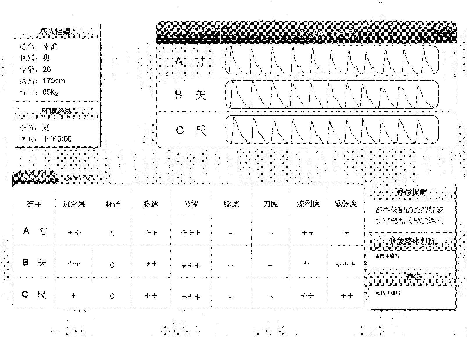 Pulse signal processing for pulse diagnosis in traditional Chinese medicine