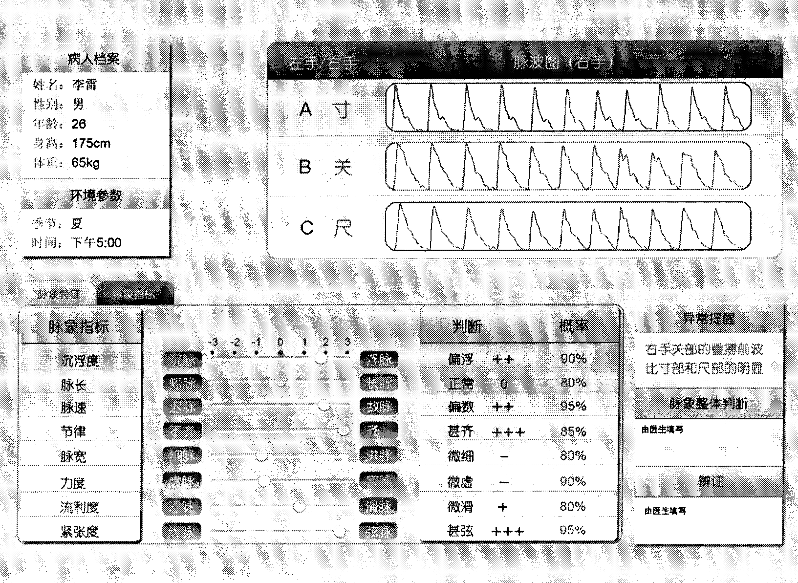 Pulse signal processing for pulse diagnosis in traditional Chinese medicine