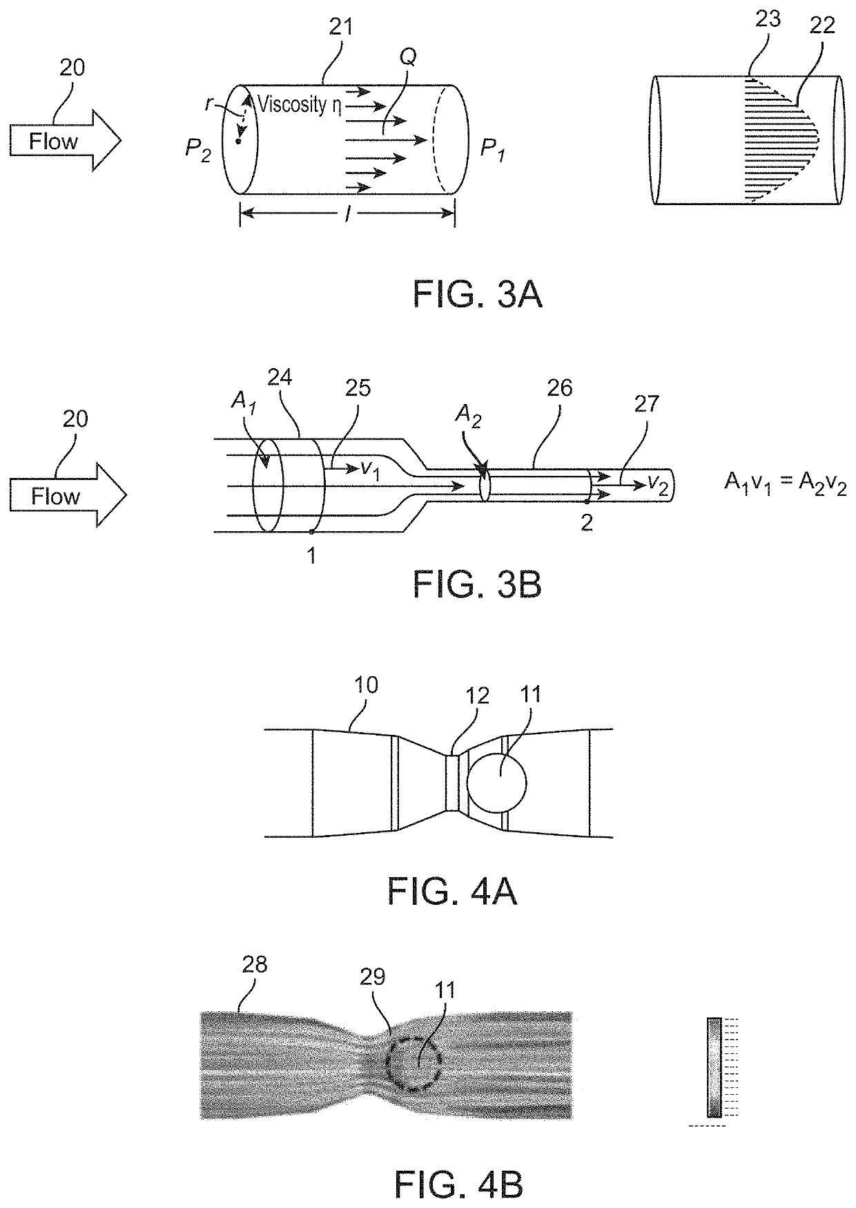 Venous valve with enhanced flow properties