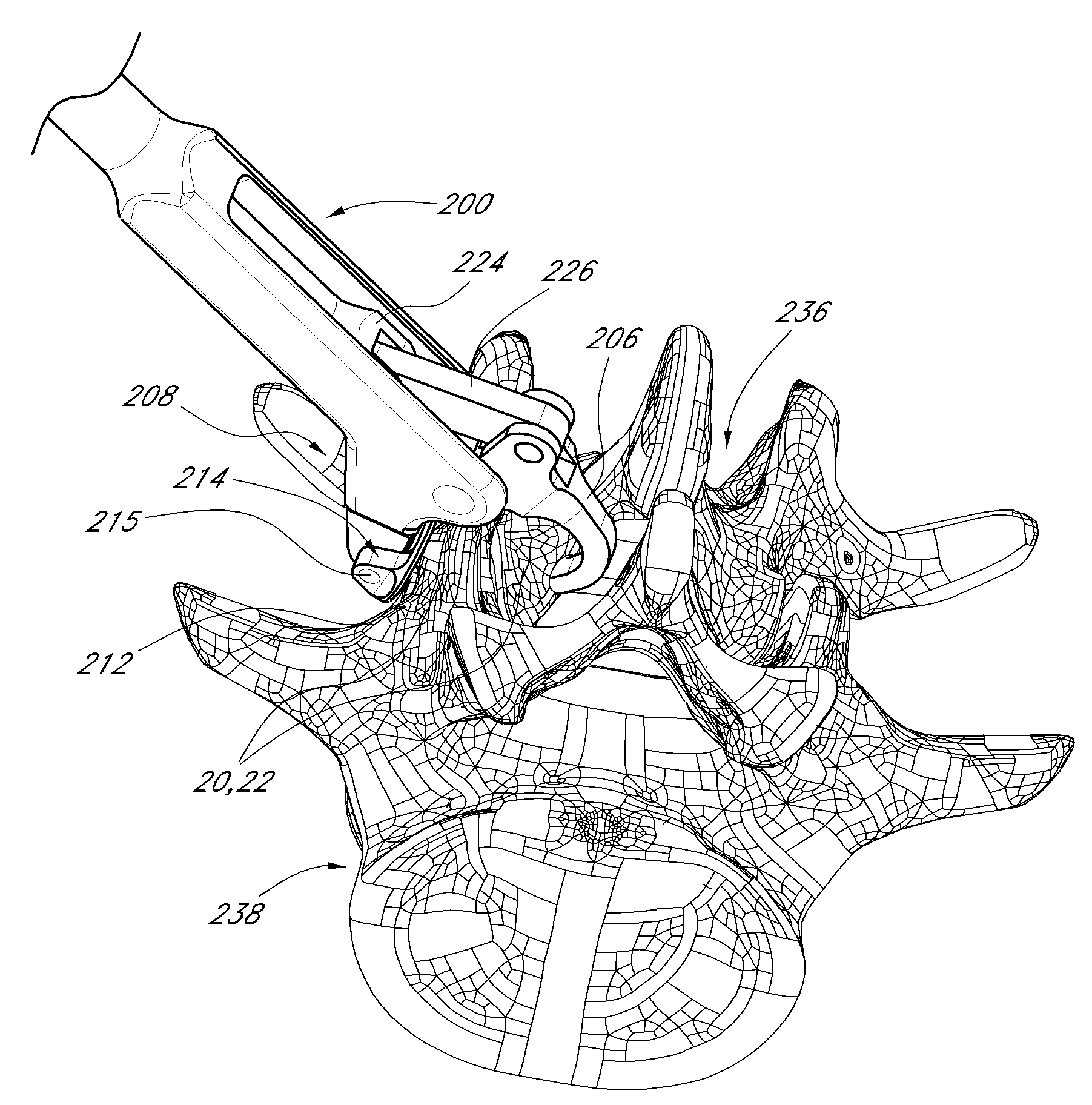 Vertebral facet joint drill and method of use