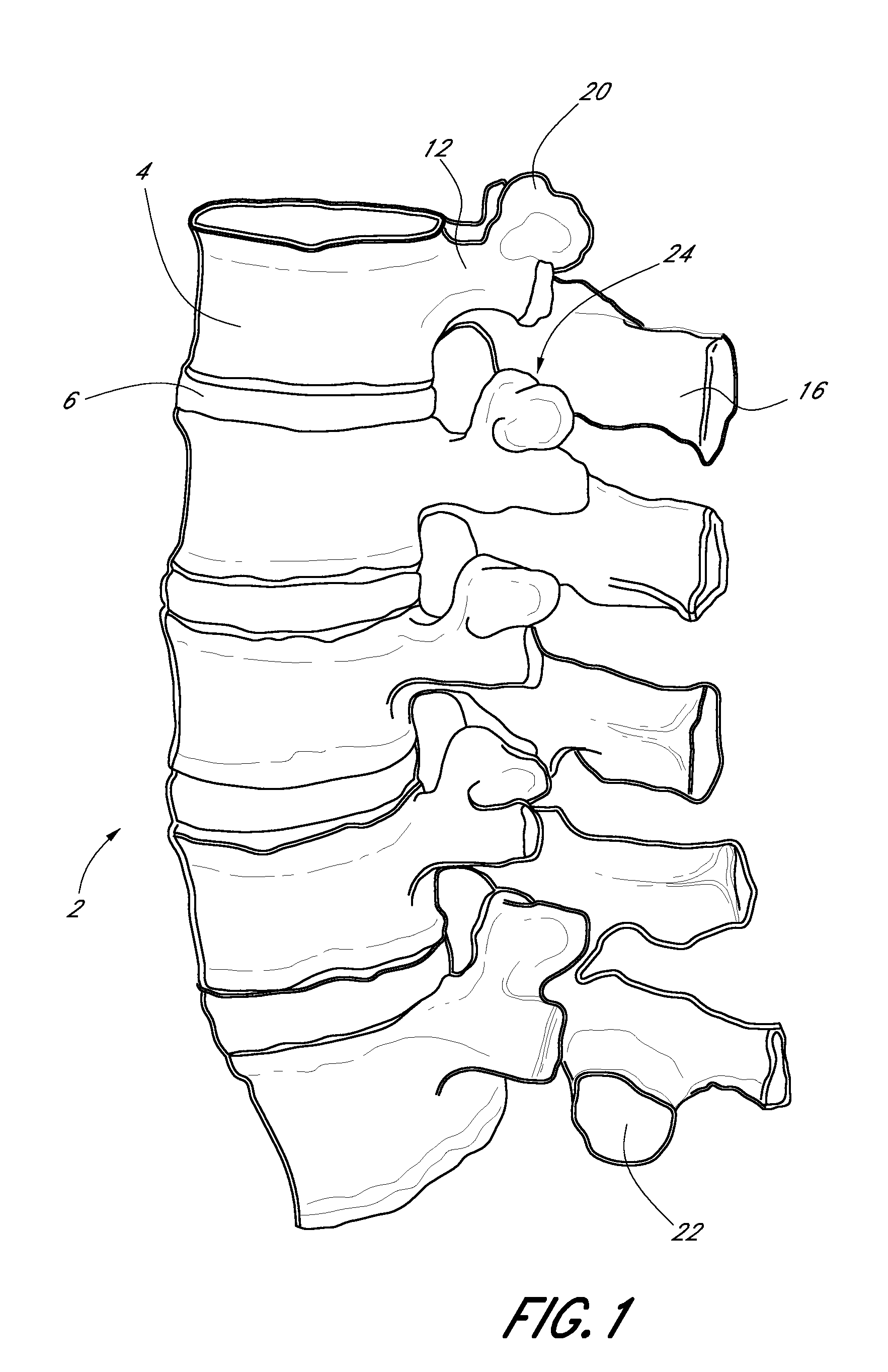 Vertebral facet joint drill and method of use