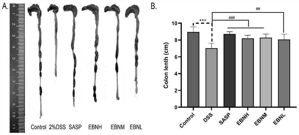 Application of cubilose in preparation of medicine for treating ulcerative colitis