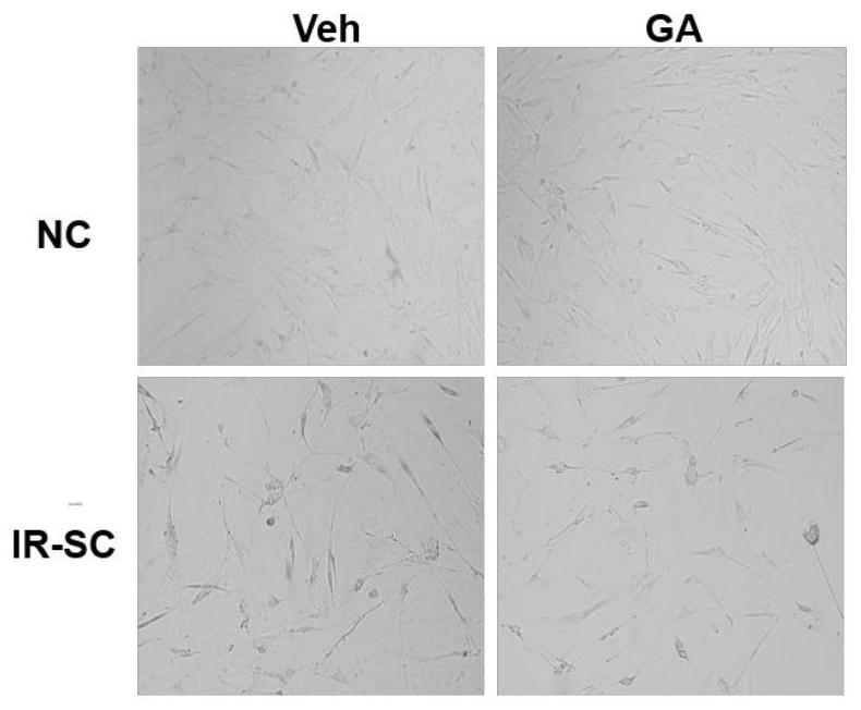 Application of glycyrrhetinic acid to prevention and treatment of stem cell senescence