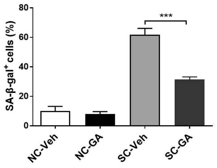 Application of glycyrrhetinic acid to prevention and treatment of stem cell senescence