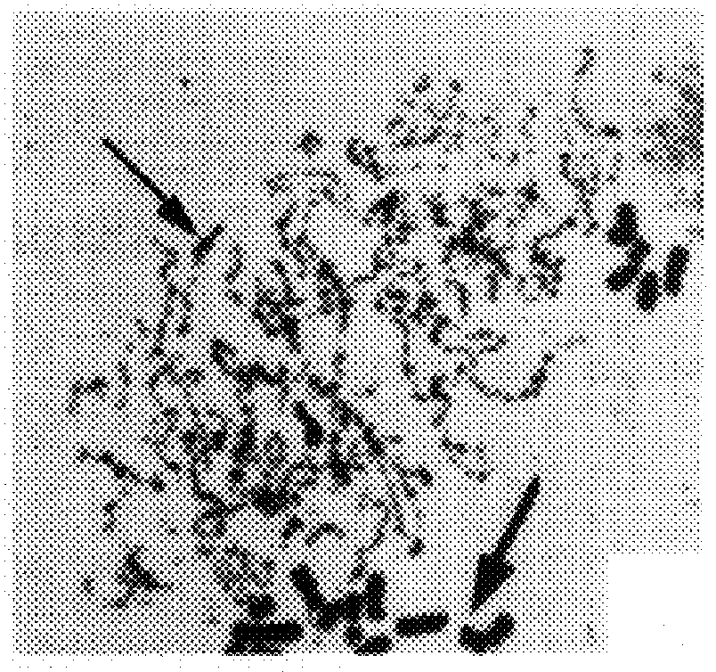 Agents and a method of chromosome preparation using protein phosphatase inhibitors induced premature chromosome condensation (PCC) technique