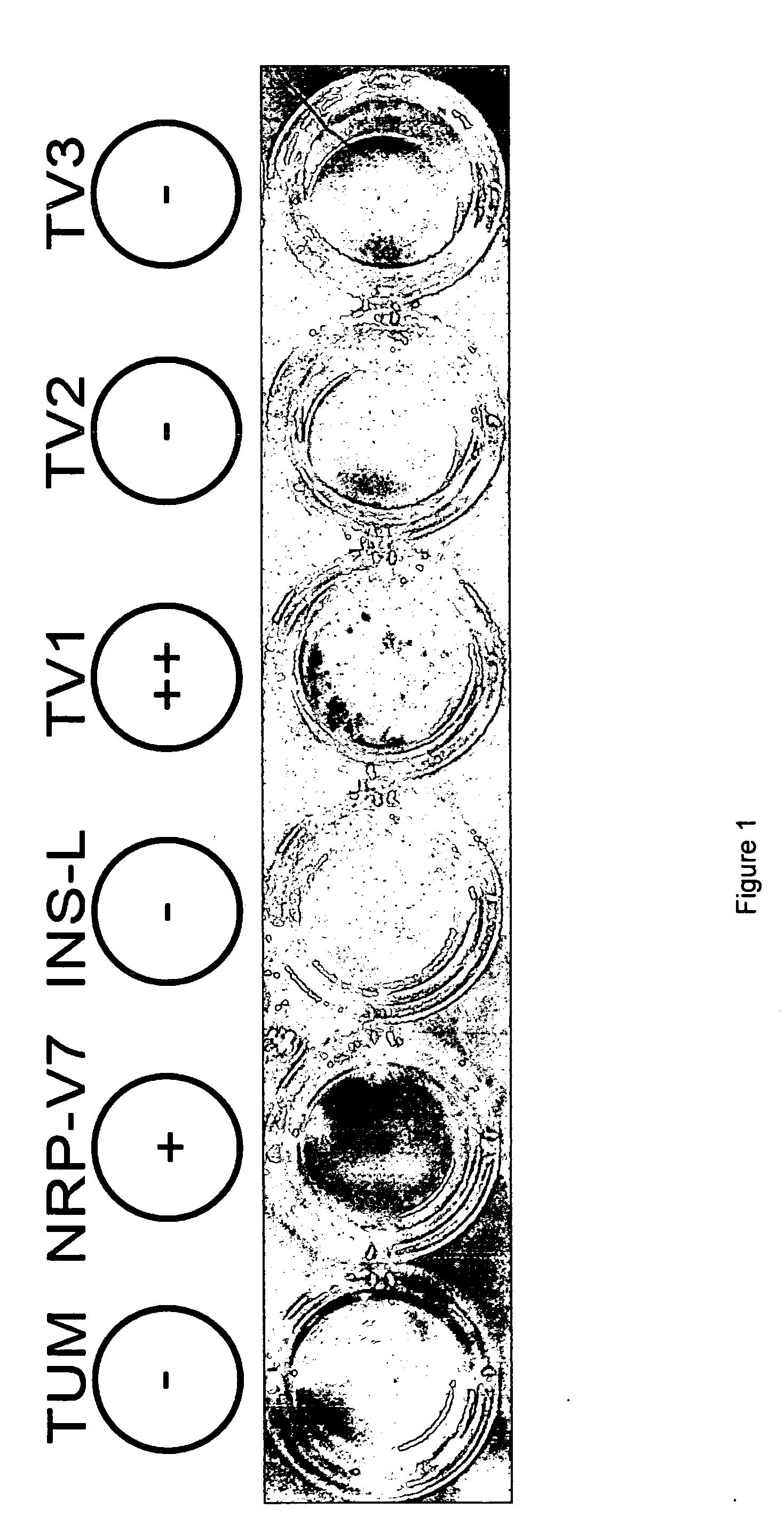 Insulin epitopes for the treatment of type 1 diabetes